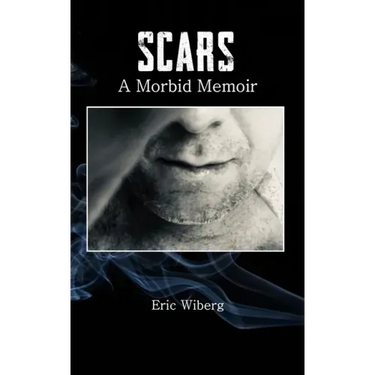 Scars: A Morbid Memoir