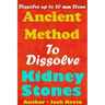 Ancient Method To Dissolve Kidney Stones: Dissolve up to 20 mm Stones