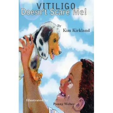 Vitiligo Doesn't Scare Me