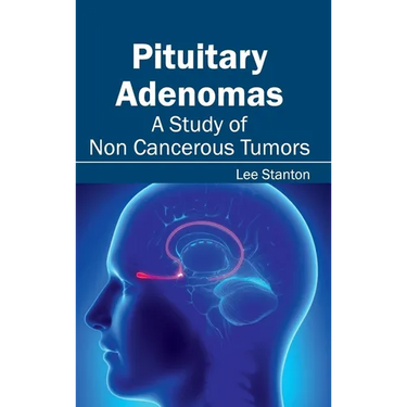 Pituitary Adenomas: A Study of Non Cancerous Tumors