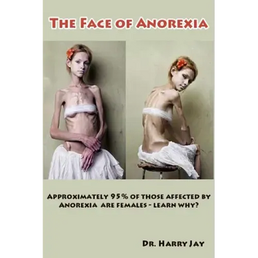 The Face of Anorexia