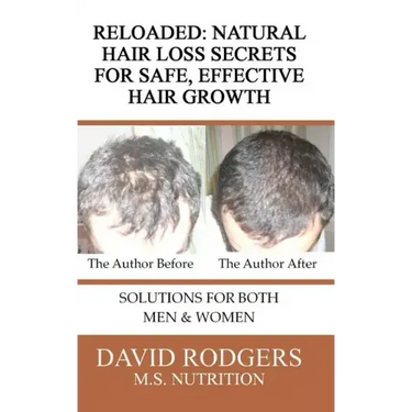 Reloaded: Natural Hair Loss Secrets for Safe, Effective Hair Growth