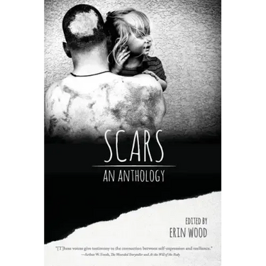 Scars: An Anthology