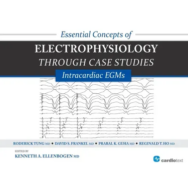 Essential Concepts of Electrophysiology Through Case Studies: Intracardiac EGMs: Intracardiac EGMs