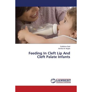 Feeding In Cleft Lip And Cleft Palate Infants