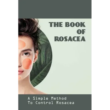 The Book Of Rosacea- A Simple Method To Control Rosacea: Rosacea Treatment For Face