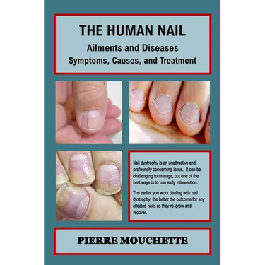 THE HUMAN NAIL - Ailments and Diseases: Symptoms, Causes, and Treatment