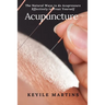 Acupuncture: The Natural Ways to do Acupressure Effectively to Treat Yourself