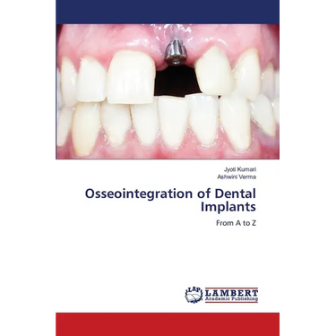Osseointegration of Dental Implants