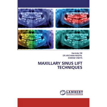 Maxillary Sinus Lift Techniques