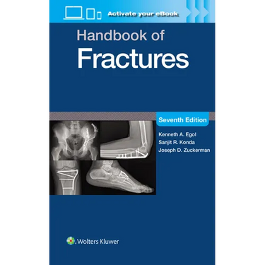 Handbook of Fractures: Print + eBook with Multimedia