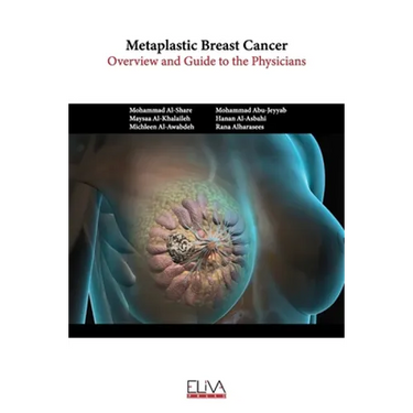 Metaplastic Breast Cancer: Overview and guide to the physicians
