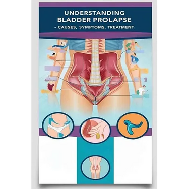 Understanding Bladder Prolapse - Causes, Symptoms, Treatment: Bladder prolapse happens when your bladder pushes through your pelvic floor and into you