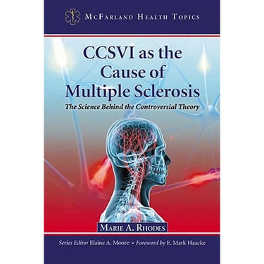 CCSVI as the Cause of Multiple Sclerosis: The Science Behind the Controversial Theory