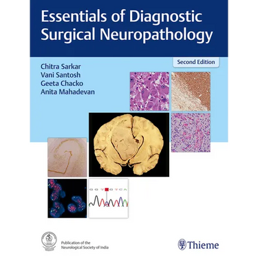 Essentials of Diagnostic Surgical Neuropathology