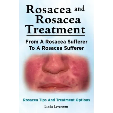 Rosacea and Rosacea Treatment. From A Rosacea Sufferer To A Rosacea Sufferer. Rosacea Tips And Treatment Options