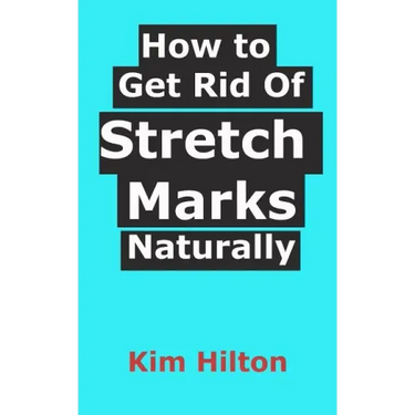 How to Get Rid Of Stretch Marks Naturally