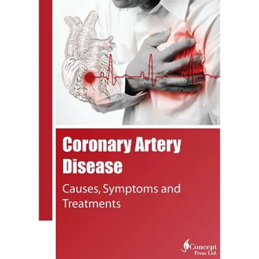 Coronary Artery Disease: Causes, Symptoms and Treatments