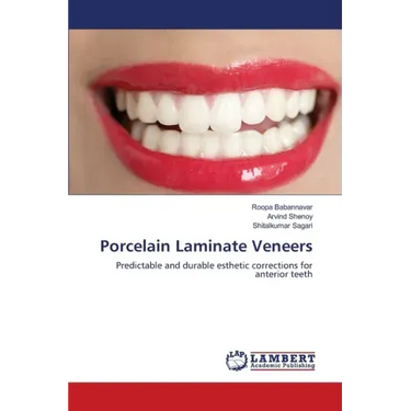Porcelain Laminate Veneers
