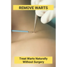 Remove Warts: Treat Warts Naturally Without Surgery: Boost Immune System To Get Rid Of Warts