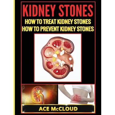 Kidney Stones: How To Treat Kidney Stones: How To Prevent Kidney Stones