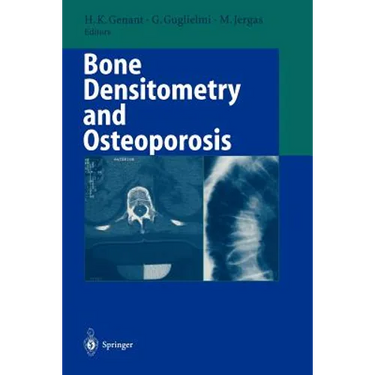 Bone Densitometry and Osteoporosis
