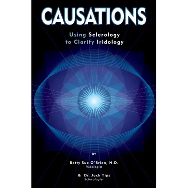 Causations: Using Sclerology to Clarify Iridology