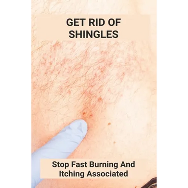 Get Rid Of Shingles: Stop Fast Burning And Itching Associated: Shingles On Face Treatment