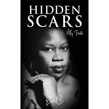 Hidden Scars: My Truth