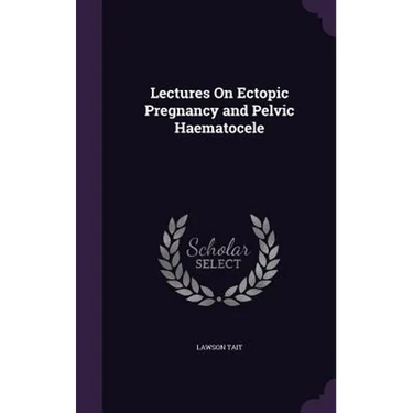 Lectures On Ectopic Pregnancy and Pelvic Haematocele
