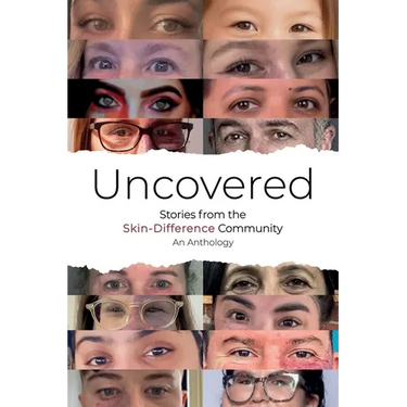 Uncovered: Stories from the Skin-Difference Community