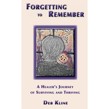 Forgetting to Remember