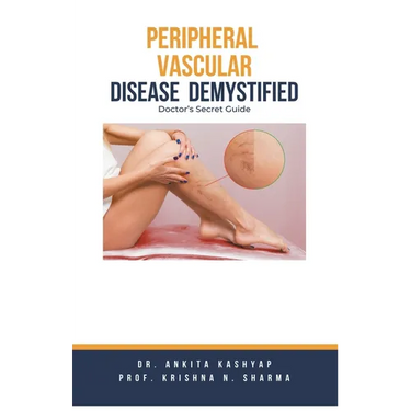 Peripheral Vascular Disease Demystified: Doctor's Secret Guide