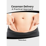 Cesarean Delivery: A Practical Approach