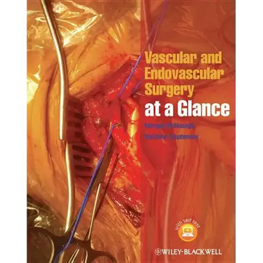 Vascular and Endovascular Surgery at a Glance