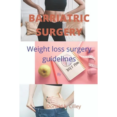 Barriatric Surgery: Weight loss surgery guidelines