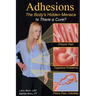 Adhesions: The Body's Inner Menace - Is There a Cure?