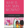 Why Is My Skin Brown?