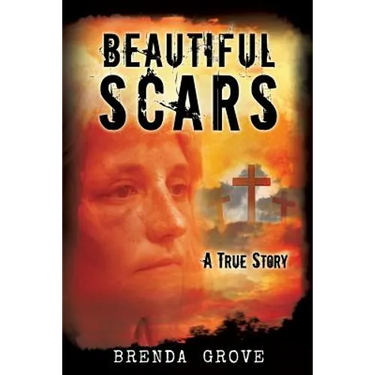 Beautiful Scars