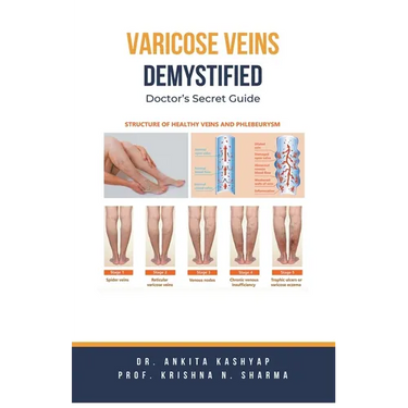 Varicose Veins Demystified: Doctor's Secret Guide