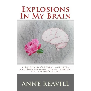 Explosions in My Brain: A Ruptures Cerebral Aneurysm and Subarachnoid Haemorrhage; A Surviver's Story