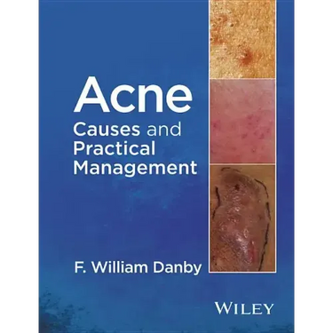 Acne: Causes and Practical Management
