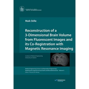 Reconstruction of a 3-Dimensional Brain Volume from Fluorescent Images and its Co-Registration with Magnetic Resonance Imaging