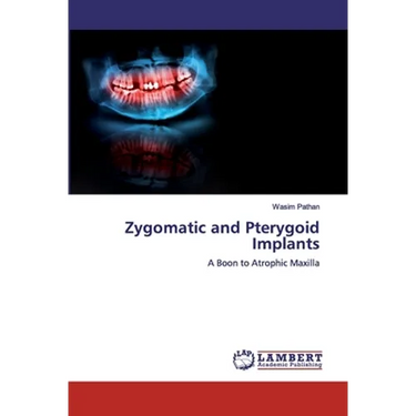 Zygomatic and Pterygoid Implants