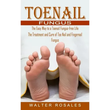 Toenail Fungus: The Easy Way to a Toenail Fungus-free Life (The Treatment and Cure of Toe Nail and Fingernail Fungus)