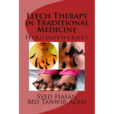 Leech Therapy in Traditional Medicine: Hirudotherapy