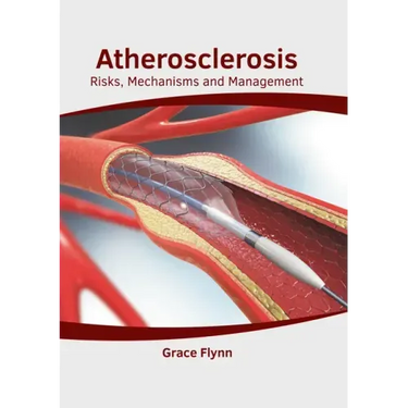 Atherosclerosis: Risks, Mechanisms and Management