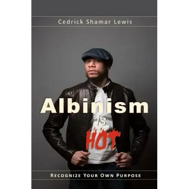 Albinism is Hot!