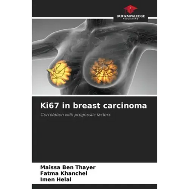 Ki67 in breast carcinoma