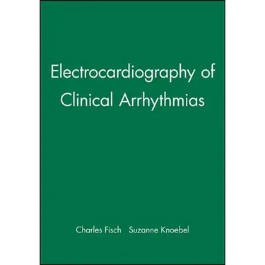Electrocardiography of Clinical Arrhythmias